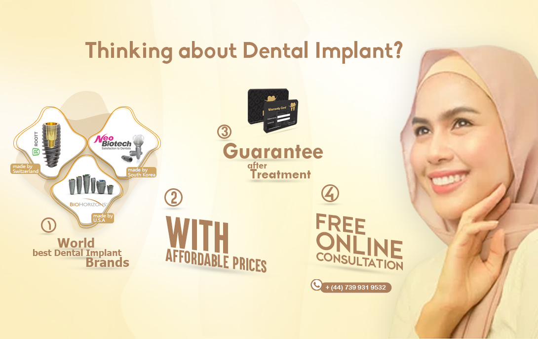 dental implant